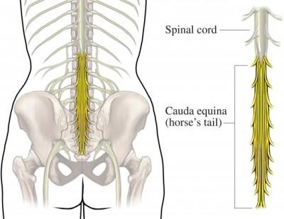 Cauda equina