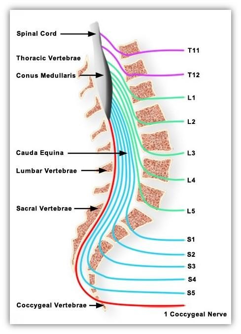 cauda equina syndrome